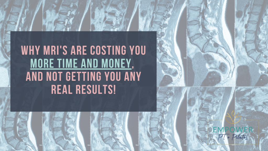 Why MRI's cost you more time and money.